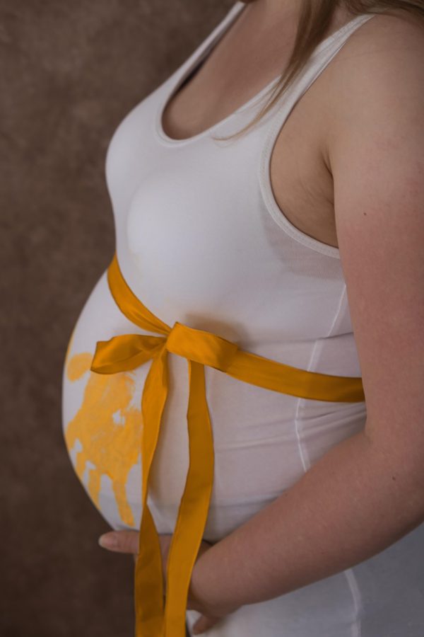 Representative photo for Baby Girls' Bermuda Shorts Baby Shorts Yellow Flowers (actual product photo pending)